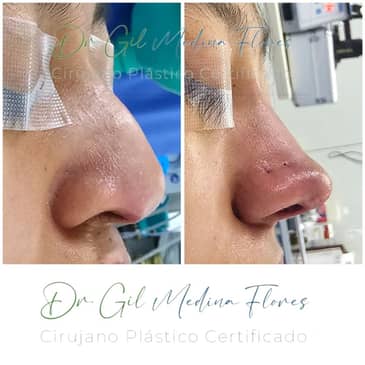 Slider image (7) Medina Flores Plastic Surgery